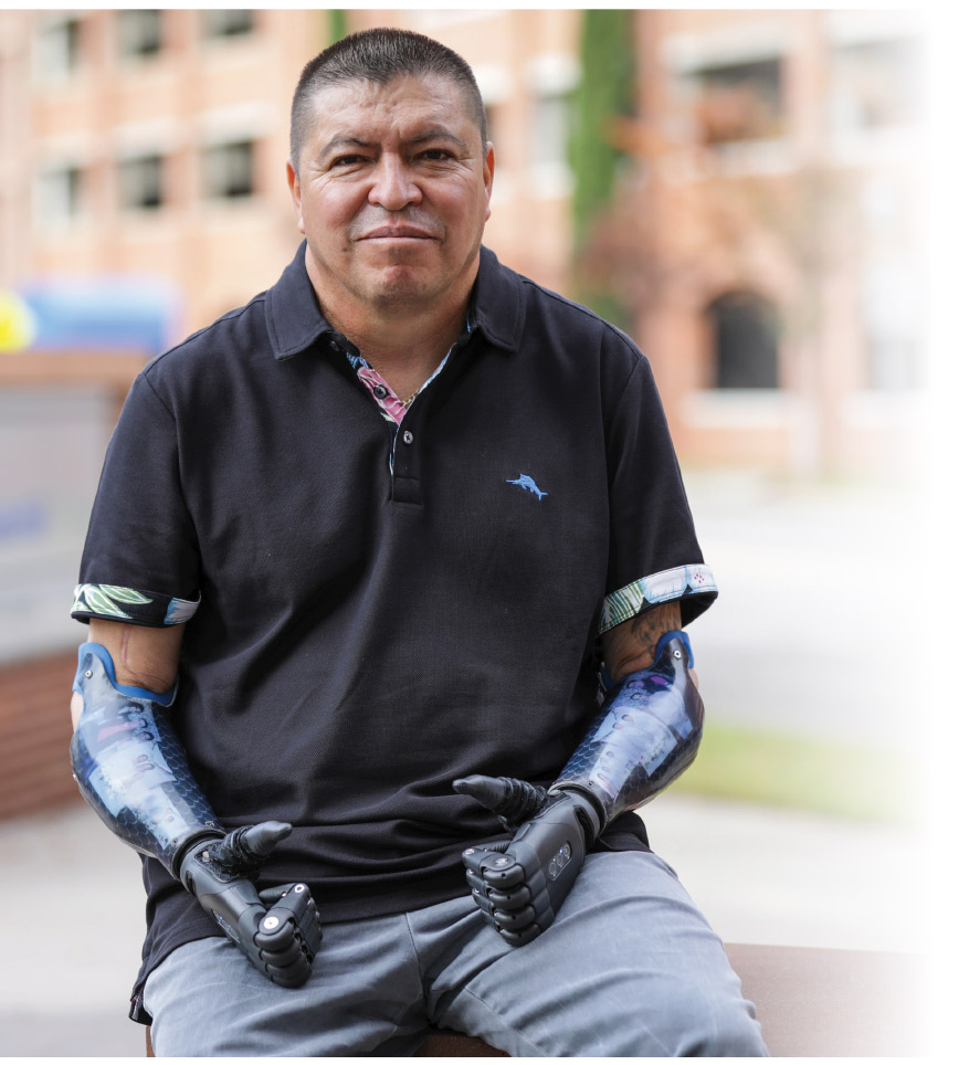 Marcial Sanchez Romero with new prosthetics