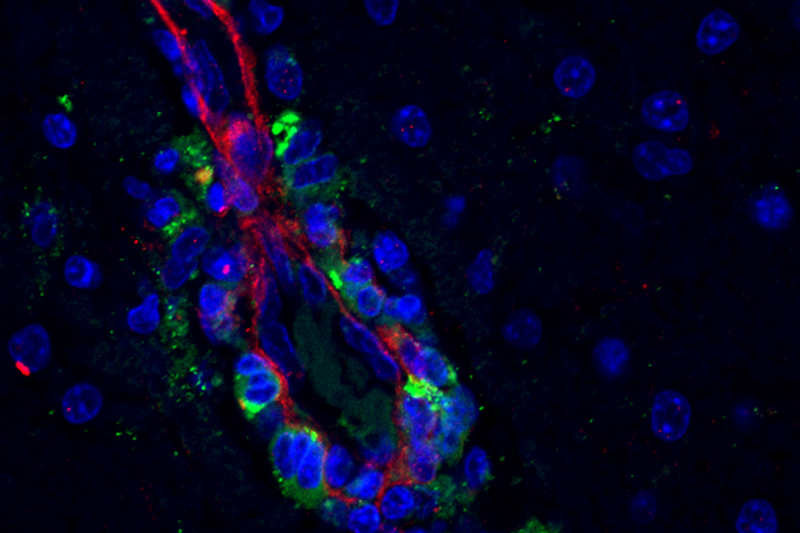 Simian Immunodeficiency Virus infected macrophages (green)surround a blood vessel (red) with cell nuclei (blue) in the brain of an infected Rhesus macaque.