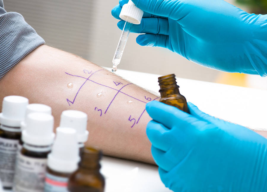 A doctor performs a skin allergy test on a person's arm
