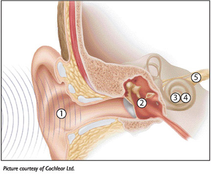 Colorful illustration of how the ear works with audio waves