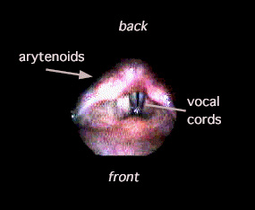 A photo of vocal cords taken during a stroboscopic exam
