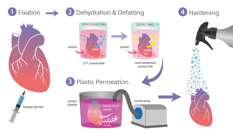 Plastination heart diagram. 1. Fixation. 2. Dehydration & defatting. 3. Plastic permeation. 4. Hardening.