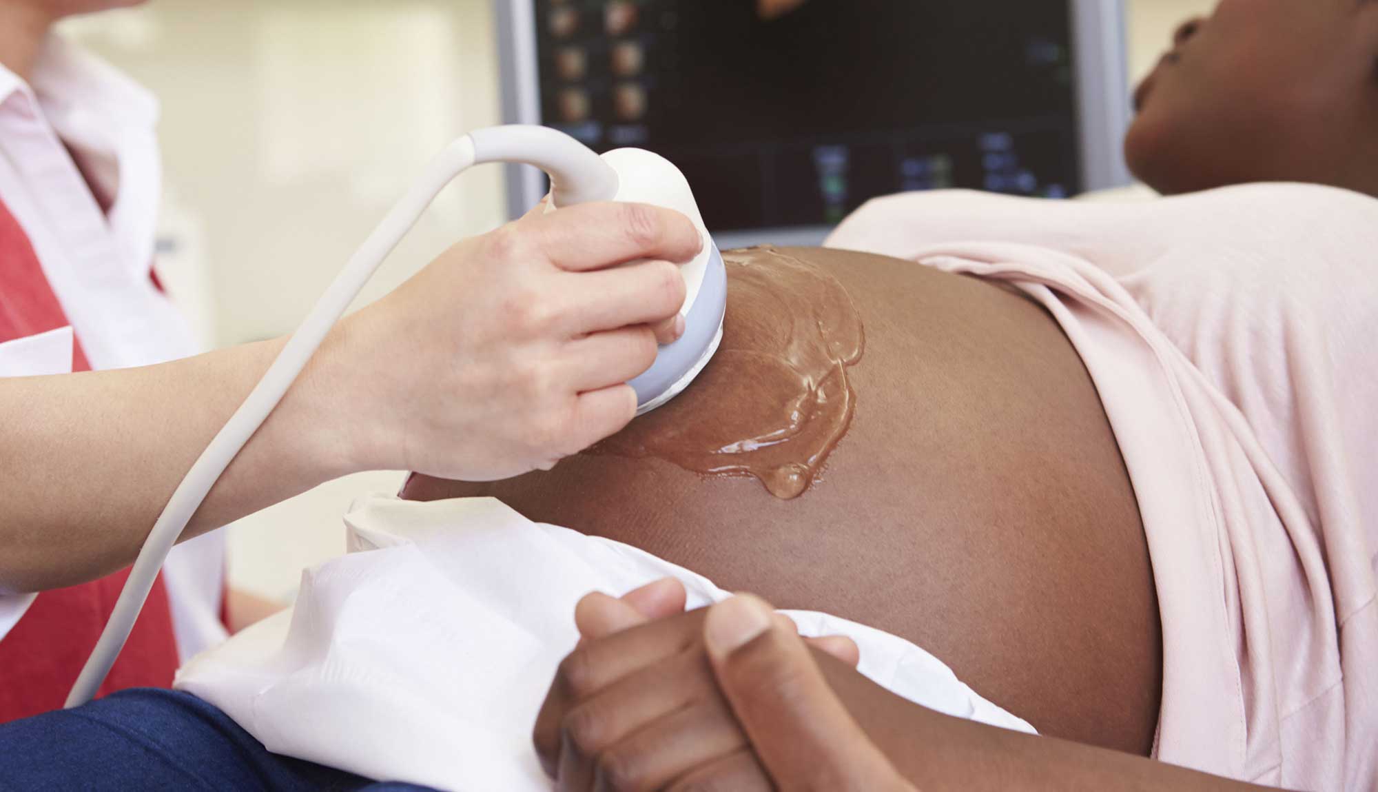 A pregnant woman gets an ultrasound.