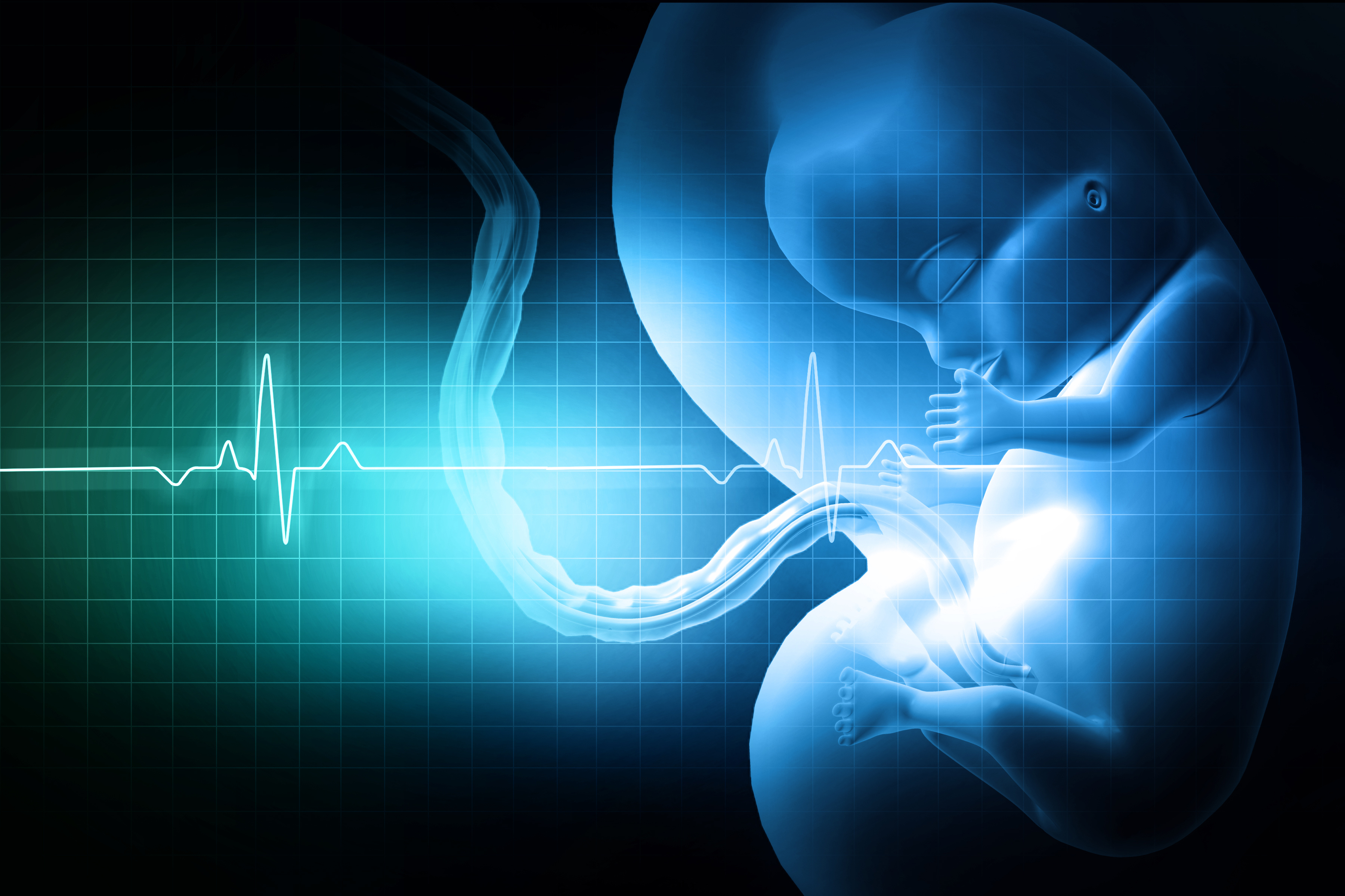 Profile of blue fetus with EKG chart superimposed