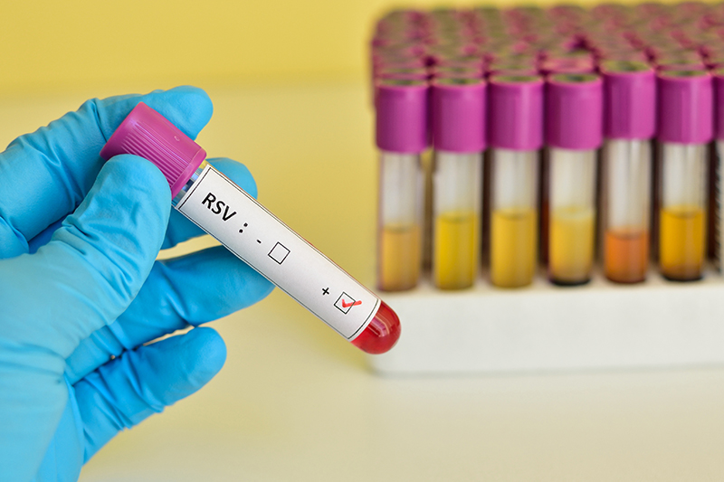 A blue-gloved hand holds a test-tube with a positive RSV test result. Other tubes are in the background.