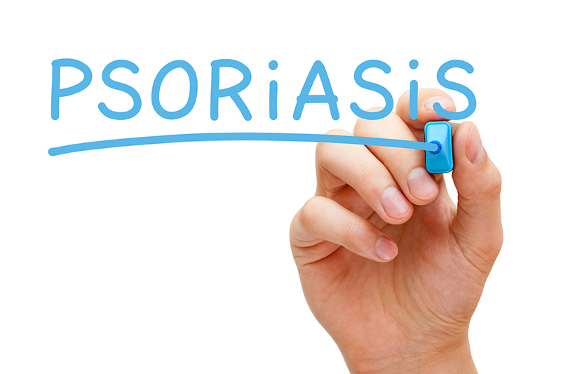 psoriasis