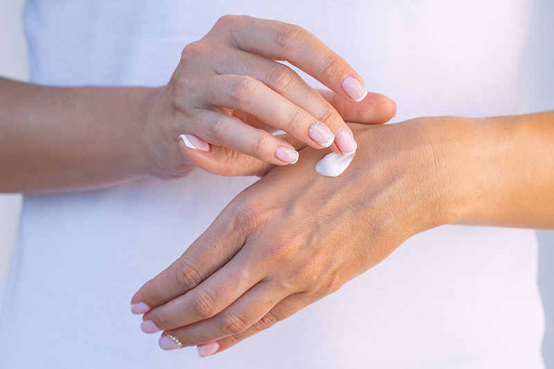 Close-up of a woman's hands. She is applying moisturizer to dry skin.