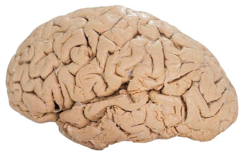 plastinated image of the human brain