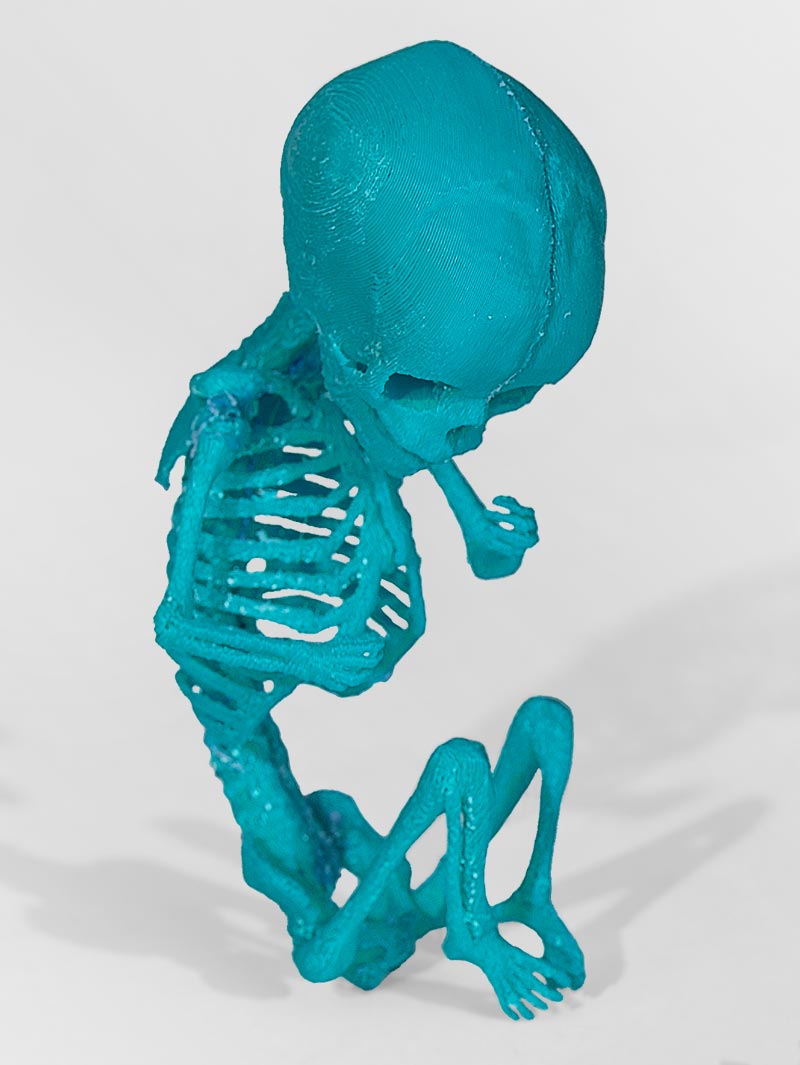 3D model of a fetal skeleton
