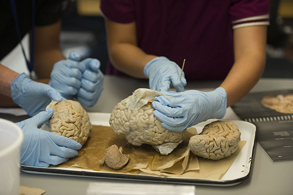 Students examine dissected brain