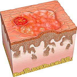 Diagram of skin cell